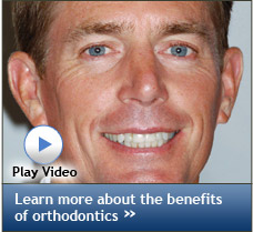 Benefits of Orthodontics Video